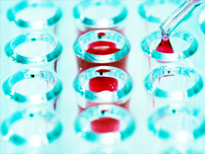  传染性单核细胞增多症检测试剂